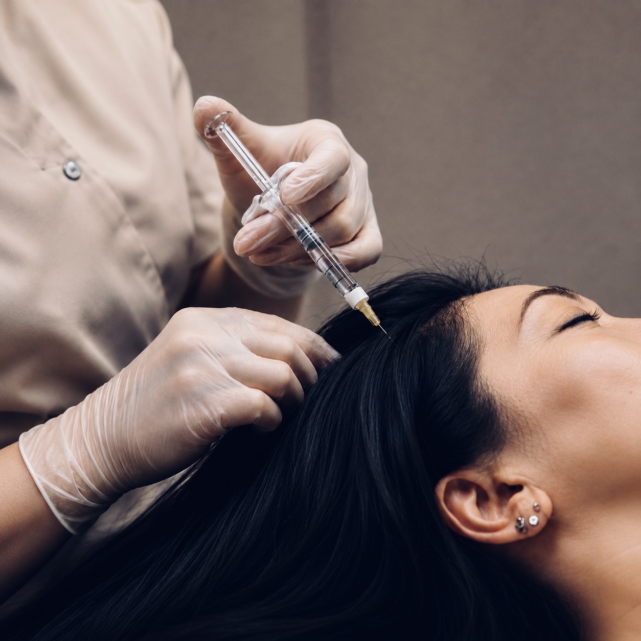 PRP hair restoration consultation